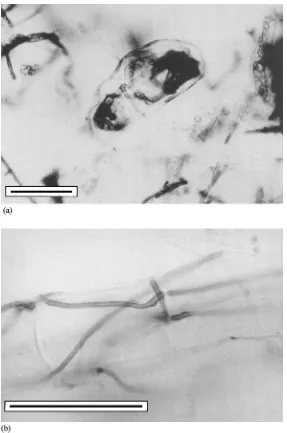 Fig. 2. (a) Detail of hyphal coil in the cortical cell of Azalea root inoculated in vitro with an ericoid mycorrhizal fungus (isolate D5)isolated from Rhododendron sp