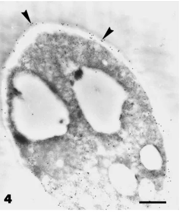 Fig. 4. Transmission electron micrographs of hyphae of P. parasit-glucan wall component
