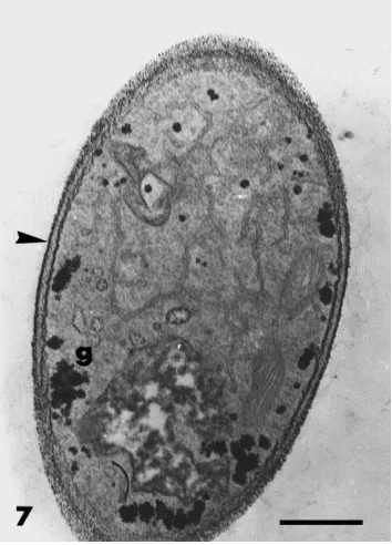Fig. 7. Transmission electron micrographs of hyphae of F. oxyspo-rum grown in the absence of Paenibacillus sp