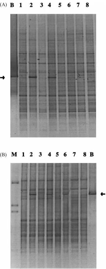 Fig. 5. Dendrograms showing clustering of PCR–DGGE generatedcommunity ﬁngerprints using UPGMA: (A) ﬁngerprints obtainedfrom bulk soil samples; (B) ﬁngerprints obtained from rhizospheresoil samples