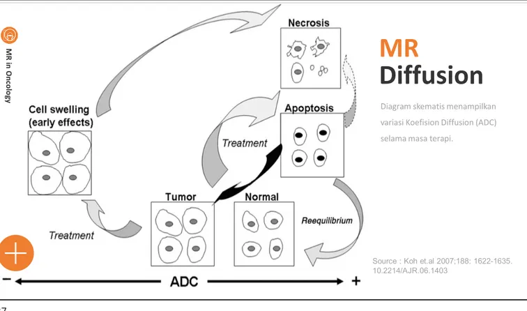 Diagram skematis menampilkan variasi Koefision Diffusion (ADC) selama masa terapi.