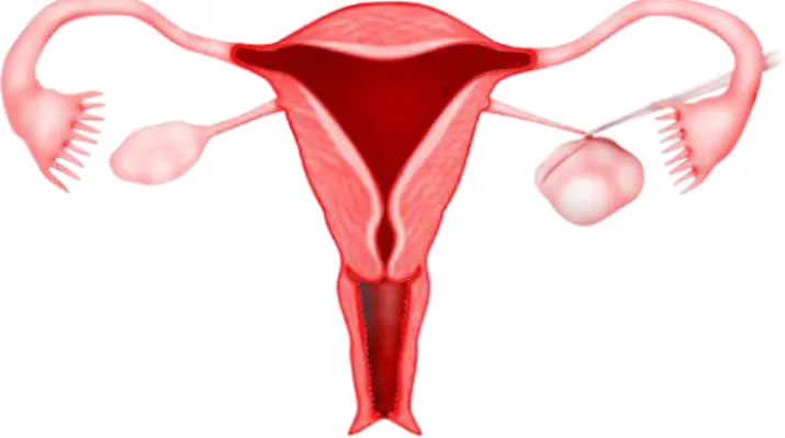 Gambar 5.7 (a) Torsi kista ovarium kiri