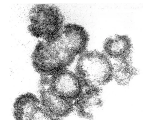 Fig. 6. Standard transmission electron microscopy (EM) analysis of the HIV–VLPA100 ng of VLPs in PBS were ﬁxed in 6.4% glutaraldehyde, post-ﬁxed with 2% osmium tetroxide for 1 h and embedded in Araldite.s produced by HighFive cells
