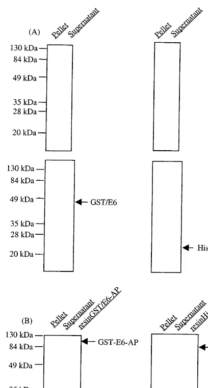 Fig. 2. Overexpression of recombinant E6 and E6AP proteins.(A) GST-tagged E6 and 6×His-tagged E6, (B) GST-taggedE6AP and 6×His-tagged E6AP