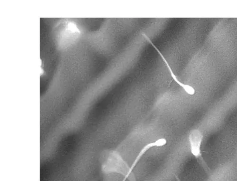 Fig. 1. Ram spermatozoa surface-labelled with fluorescein isothiocyanate and cooled to y408C on thecryomicroscope stage at 308Crmin in the presence of 300 mgrml rhodamine in phosphate-buffered saline.The fluorescence in the background highlights regions wh