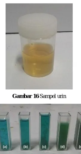 Gambar 17 Sampel urin setelah 