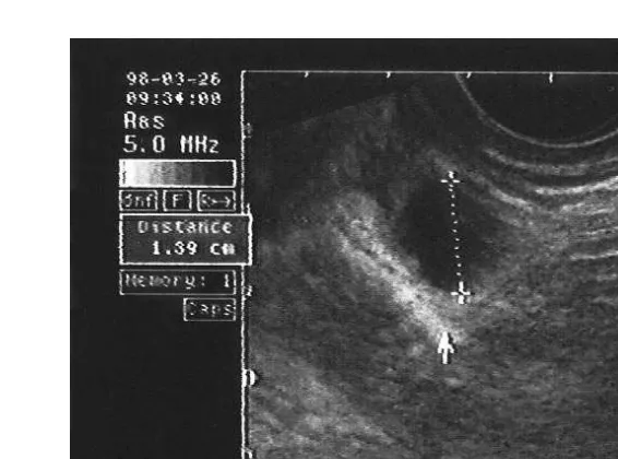 Fig. 1. Graffian follicle in ovary of post parturient 34 days she camel.Ž.