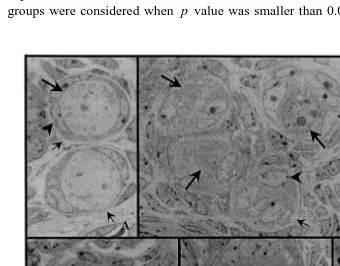 Fig. 1. Microphotographs of the primordial and the primary follicles in normal and irradiated mouse ovaries.The identification of normal and atretic primordial and primary follicles based on the criteria depicted in Tablecells; white thick arrow, follicles