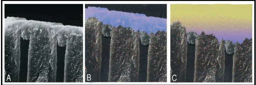 Gambar 5. Mekanisme perlekatan self-etching primer A. smear layer yang melekat pada permukaan dentin B