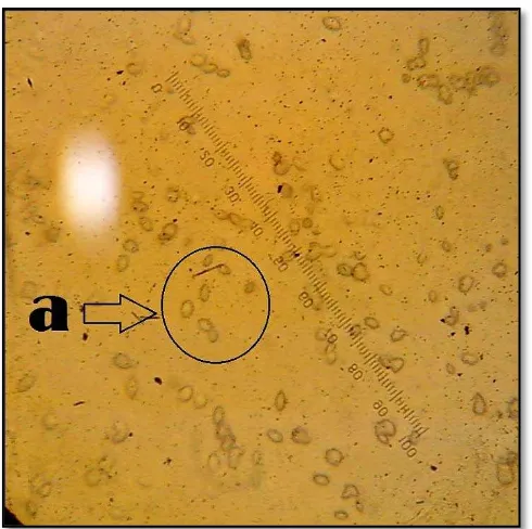 Gambar 7. Fungi Cryptosporiopsis spp. a: macro                     conidia (single-celled)
