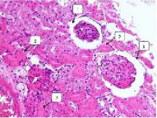 Gambar 5. Histopatologi ginjal tikus kelompok perlakuan 4 (Perbesaran 400x). Keterangan: 1