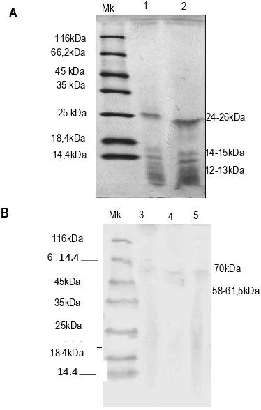 Gambar 2.   Zimogram ekstrak enzim bebas garam. a. tampilan normal; Marker (Mk). b,c tampilan invert (zona bening menjadi 