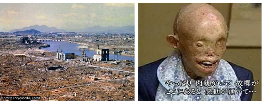Gambar 1Akibat Nuklir Hiroshima
