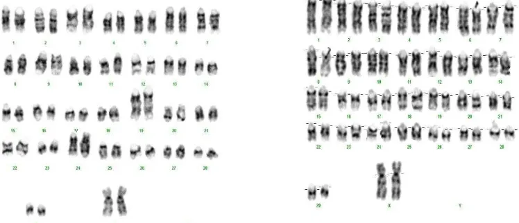 Figure 2. Cattle Chromosome showed a normal numbers of 30 pairs. xB, Kariotyping using software image of cytovision.