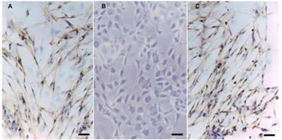 Gambar 6. Metode Immunocytochemistry of S-100 dengan Media SLCs. 