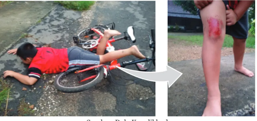 Gambar 6.1  Anak Terjatuh dari Sepeda dan Terjadi Luka pada Lutut