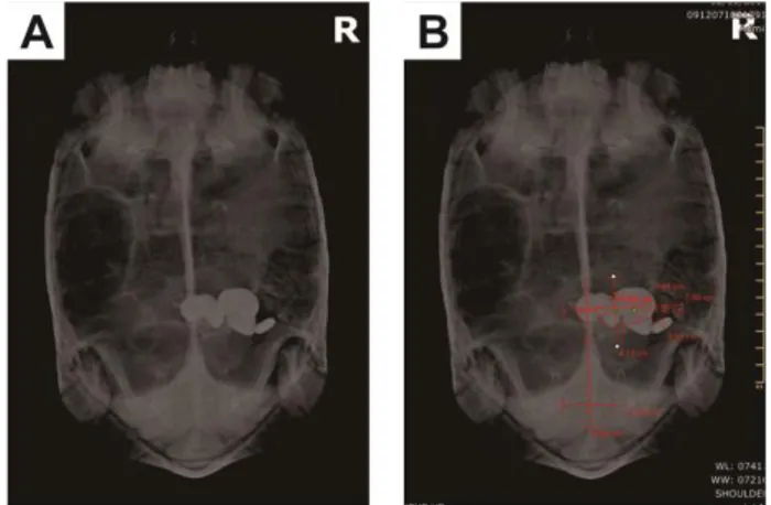 Gambar 1. Hasil radiografi posisi Dorso Ventral (DV). (A) Tampak bentukan radiopaque di area             abdomen; (B) Tampak ukuran dan jumlah benda asing 