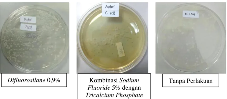 Gambar 1.  Biakan Bakteri dalam Saliva Anak yang Dilakukan Aplikasi Difluorosilane 0,9%, Kombinasi  Sodium Fluoride 5% dengan Tricalcium Phosphate, dan Tanpa Perlakuan