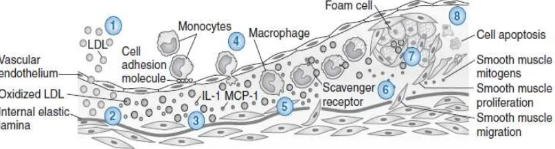 Gambar 2.1 Diagram evolusi plak aterosklerosis (Libby, 2002) 
