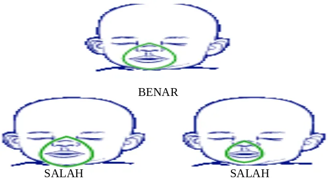 Gambar 5.3 Cara pemasangan Sungkup