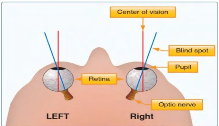 Figure 1.1: Human eye blind spot (Lin and Li 2010). 