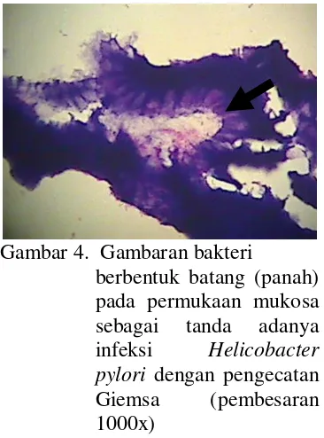 Gambar 4.  Gambaran bakteri 