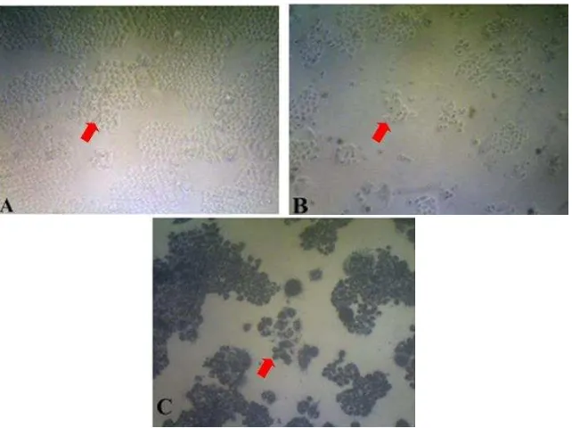 Gambar 3. Pengaruh perlakuan ekstrak etanol daun sirsak terhadap sel HeLa  