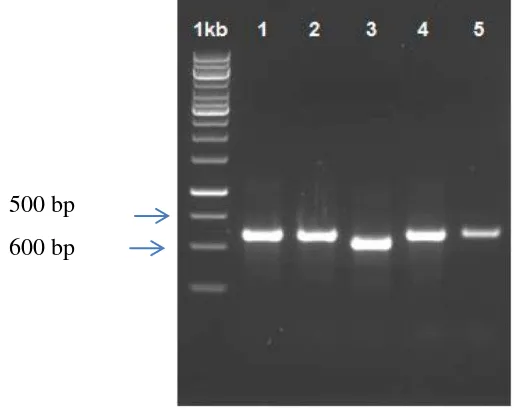 Gambar 7 Hasil elektroforesis fungi endofit dari akar S. leprosula dengan menggunakan ITS1 dan ITS4 (1 :dan S