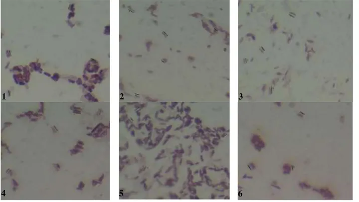 Gambar 2. Pewarnaan Gram isolat 6 spesies Bacillus 