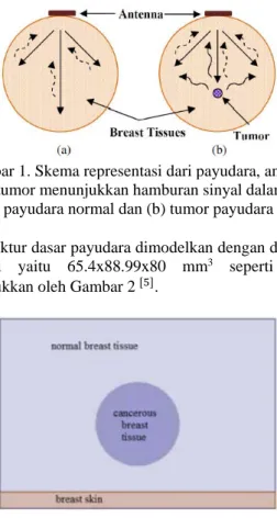 Gambar 1. Skema representasi dari payudara, antenna  dan tumor menunjukkan hamburan sinyal dalam (a) 