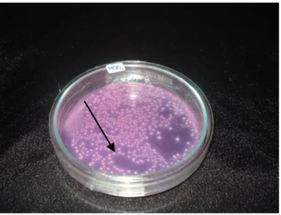 Gambar 1. Koloni bakteri yang berasal dari tanah yang tumbuh pada media NGKG 