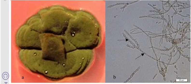 Gambar 5 Cladosporium sp. asal Zingiberaceae a. koloni pada PDA, b. konidiofor dan rantai konidia