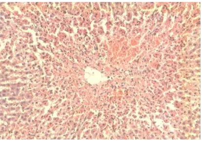 Gambar 2.3 Gambaran histopatologi hati akibat keracunan parasetamol             menunjukkan adanya gambaran nekrosis di sentrilobuler (10x10)          (Junqueira dan Corneiro, 1998)