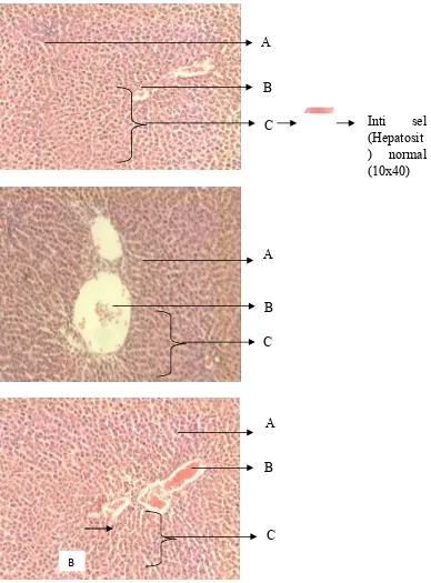 Gambar 4.1 Histologi hati tikus putih kontrol normal yang menunjukkan hepatosit tersusun radial (10 x 10) Keterangan Gambar : A (Sinusoid yang membatasi antara lempeng lempeng hepatosit); B (Vena sentral); C (Hepatosit yang tersusunsecara radial)  