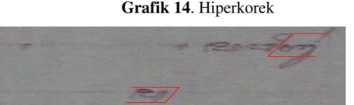 Grafik 14. Hiperkorek  
