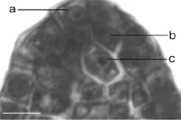 Figure 3. a. microspore mother cells of S. formosa before meiosis, b.microspores tetrads of S