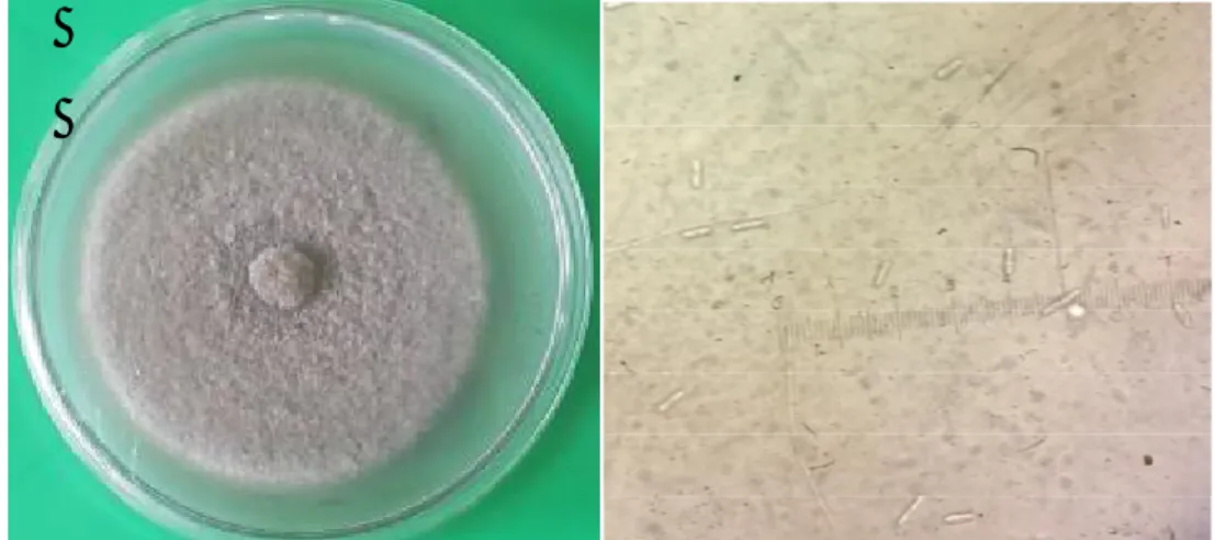 Gambar 1. Pertumbuhan koloni Fusicoccum pada media PDA pada 8 hari setelah  inokulasi (kiri) dan konidia patogen Fusicoccum pada perbesaran 400   x (Fairuzah,2018)