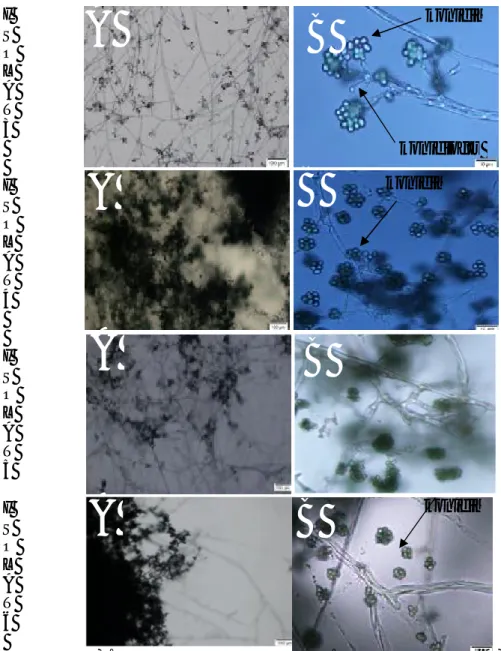 Gambar 3. Enam isolat Trichoderma spp. secara mikroskopis(A)  perbesaran 10x  (B) perbesaran 100x