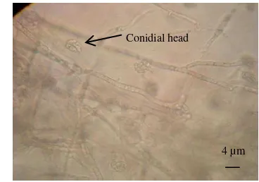 Fig 1. Microscopic features of conidial heads of Acremonium  IPBCC 08.563 