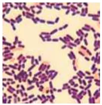 Gambar 2 Pewarnaan Gram bakteri Lactobacillus sp. 