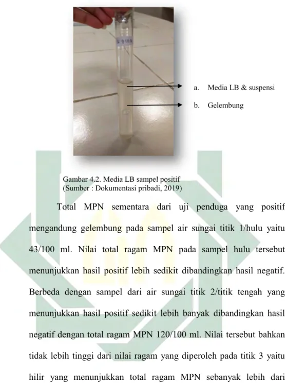 Gambar 4.2. Media LB sampel positif  (Sumber : Dokumentasi pribadi, 2019)