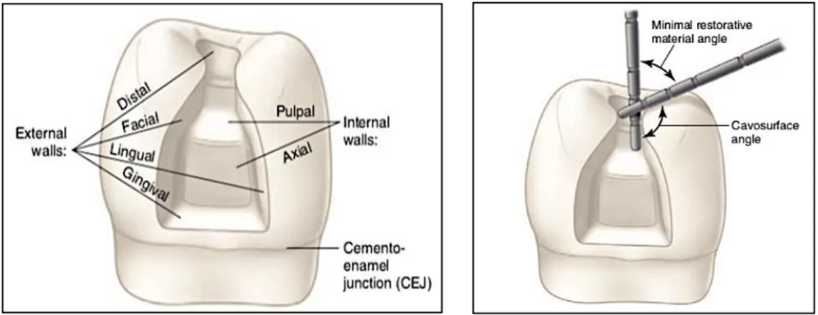 Gambar 4.1 Dinding eksternal dan internal untuk preparasi gigi. 