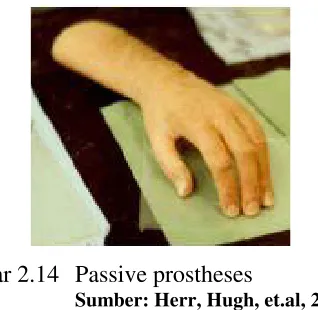 Gambar 2.14 Passive prostheses 