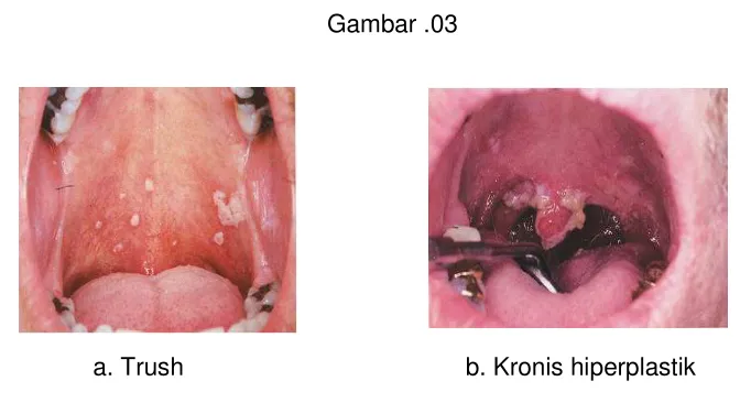 Gambar .03  