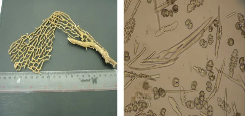 Gambar 16.  Spesimen kering Annella sp.4 (kiri) dan spikula (kanan) dibawah mikroskop elektron (tanpa 