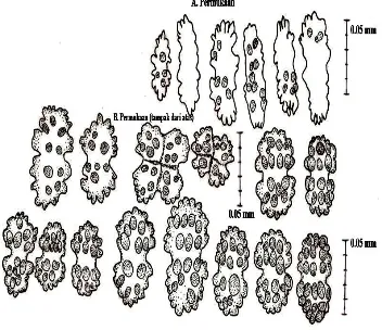 Gambar 17.  Re-drawing sklerit Verucella sp terdiri atas permukaan menggunakan mikroskop kamera lucida 