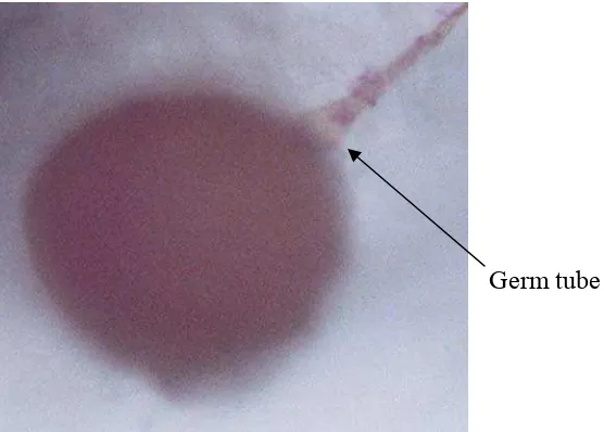 Gambar 3. Tabung perkecambahan (germ tube) spora FMA perlakuan F3M1   pada kultur cawan petri tanpa tanaman inang   
