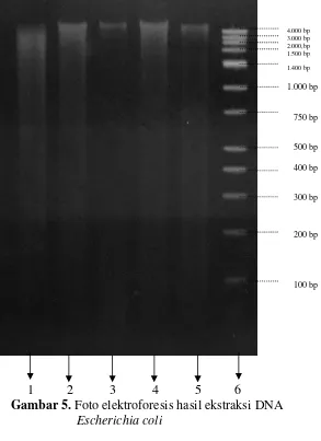 Gambar 5. Foto elektroforesis hasil ekstraksi DNA 