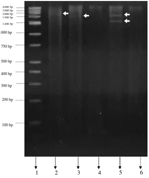 Gambar 6. Foto elektroforesis hasil pemotongan DNA                     Escherichia coli dengan enzim restriksi EcoRI  