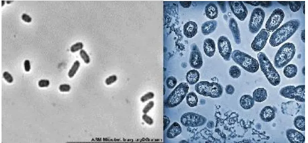 Gambar 1. Escherichia coli (kiri), Salmonella typhi (kanan) (www.apsnet.org) 